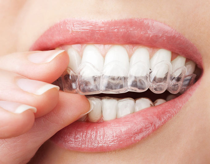 Αρχική Tachmatzidis Dental Care - Οδοντιατρείο Θεσσαλονίκη