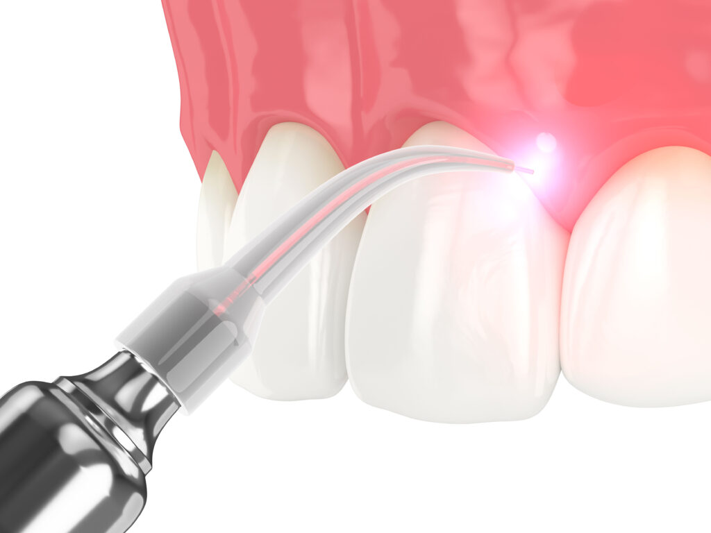 Laser Tachmatzidis Dental Care - Οδοντιατρείο Θεσσαλονίκη Laser Tachmatzidis Dental Care - Οδοντιατρείο Θεσσαλονίκη