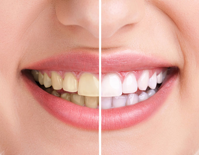 Αρχική Tachmatzidis Dental Care - Οδοντιατρείο Θεσσαλονίκη